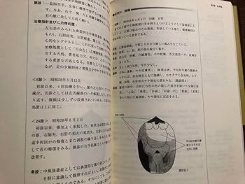 Amazon.co.jp: 胃の気の脈診 : 図解針灸脈診法 : ドラッグストア